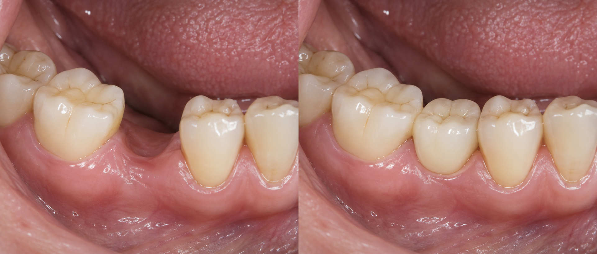 Illustrative dental implants concept visual